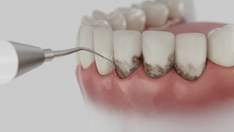Trusted Wisdom Tooth Removal service in Rockwood, VA - Dentist Open Now